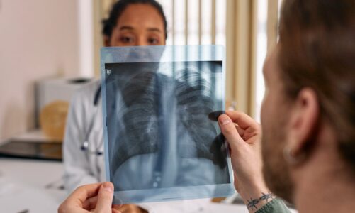 Pulmonary Fibrosis Foundation and Pulmonary Hypertension Association Provide Guidance on Pulmonary Hypertension Related to Interstitial Lung Disease