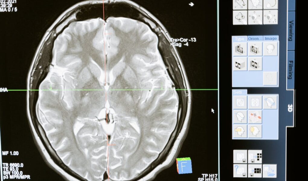 Darmiyan BrainSee FDA Approval for Alzheimer's Diagnosis