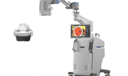 Beyeonics Maverick augmented reality surgical system
